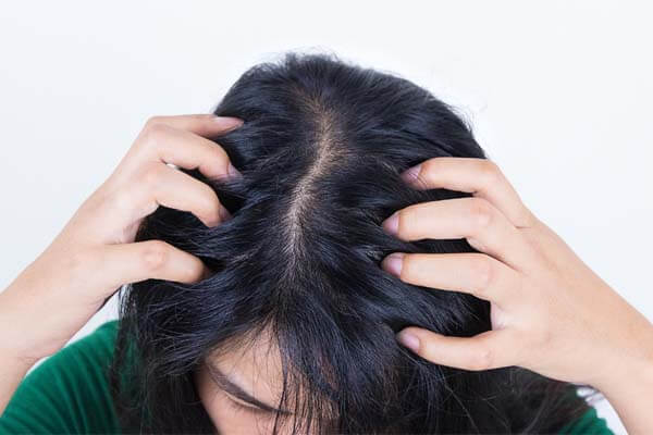 Top 10 New Year Hair Care Resolutions For 2024 5 I will Keep My Hair Dandruff and Flake Free