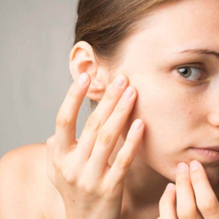 Oily Skin Product Recommendation, Dos & Don'ts to follow in 2021