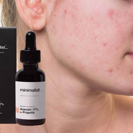 Benefits of Minimalist 17% Azeclair Anti-Acne Face Serum