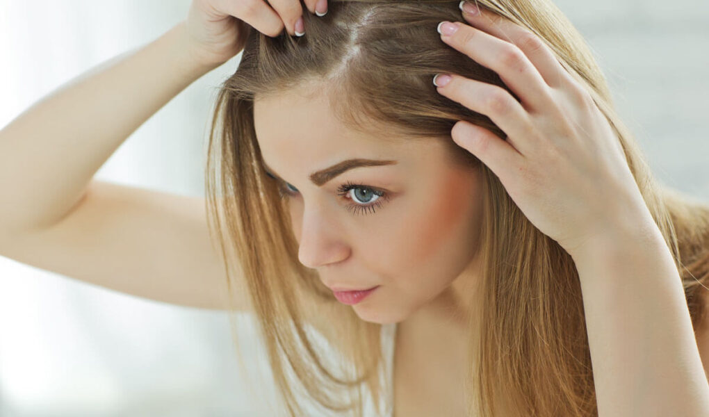 How to Give Immediate Relief to Dandruff