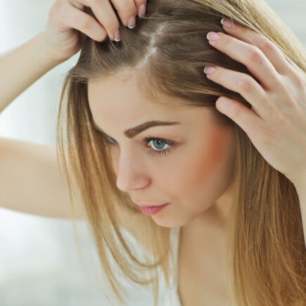 How to Give Immediate Relief to Dandruff