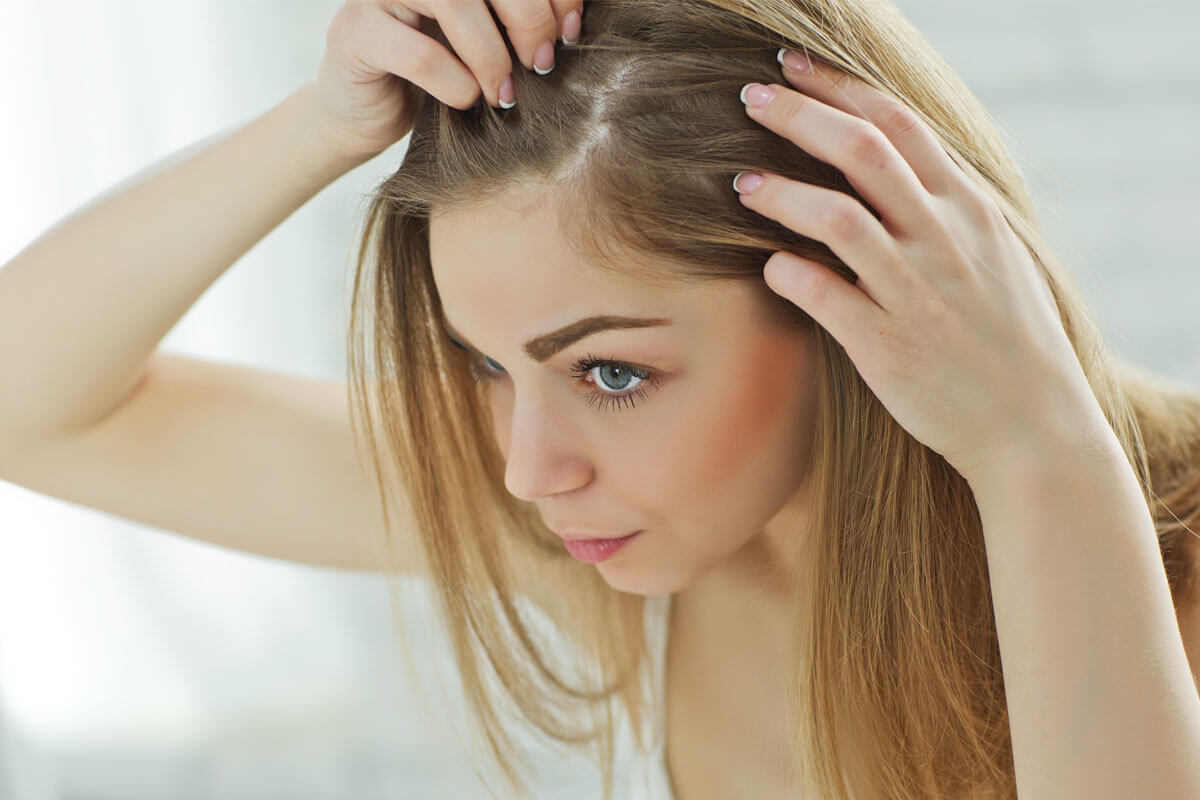 How to Give Immediate Relief to Dandruff