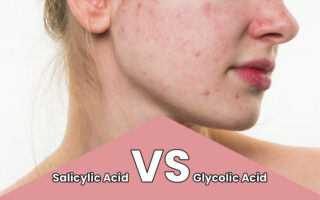 Salicylic-Acid-VS-Glycolic-Acid-Which-Is-Good-For-Acne-1.jpg File type: image