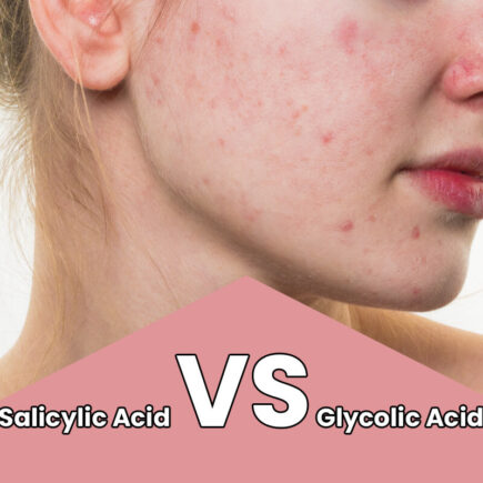 Salicylic-Acid-VS-Glycolic-Acid-Which-Is-Good-For-Acne-1.jpg File type: image
