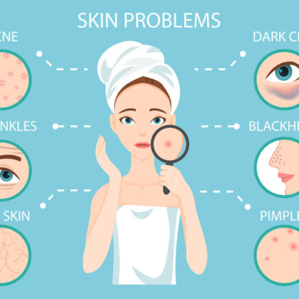Homemade Ingredients For Your Skin Problems On Face
