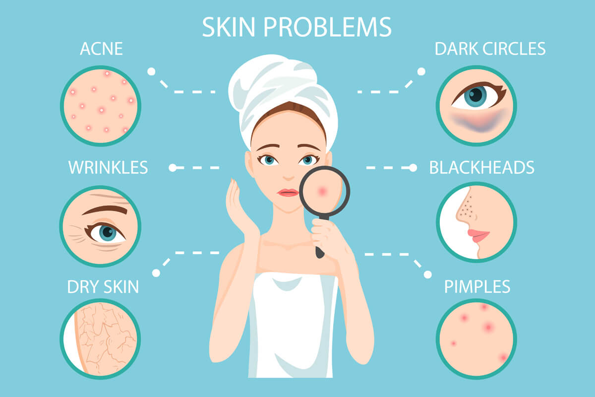 Homemade Ingredients For Your Skin Problems On Face