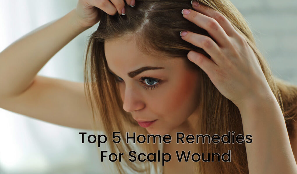 Top 5 Home Remedies For Scalp Wound and Scalp Pimples