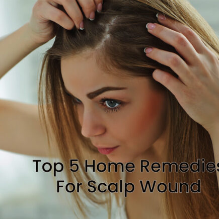 Top 5 Home Remedies For Scalp Wound and Scalp Pimples