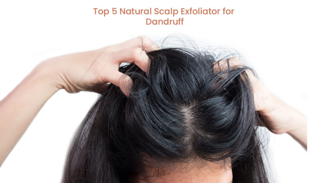 Top 5 Natural Scalp Exfoliator to Use at Home to Get Rid of Dandruff