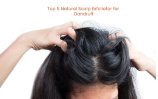 Top 5 Natural Scalp Exfoliator to Use at Home to Get Rid of Dandruff