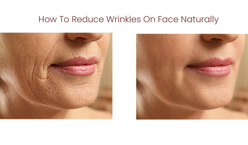 Top 10 Natural Way to Reduces Wrinkles - How To Reduce Wrinkles On Face Naturally 1 How To Reduce Wrinkles On Face Naturally
