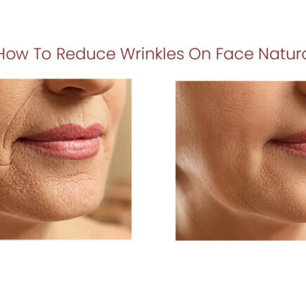 How To Reduce Wrinkles On Face Naturally