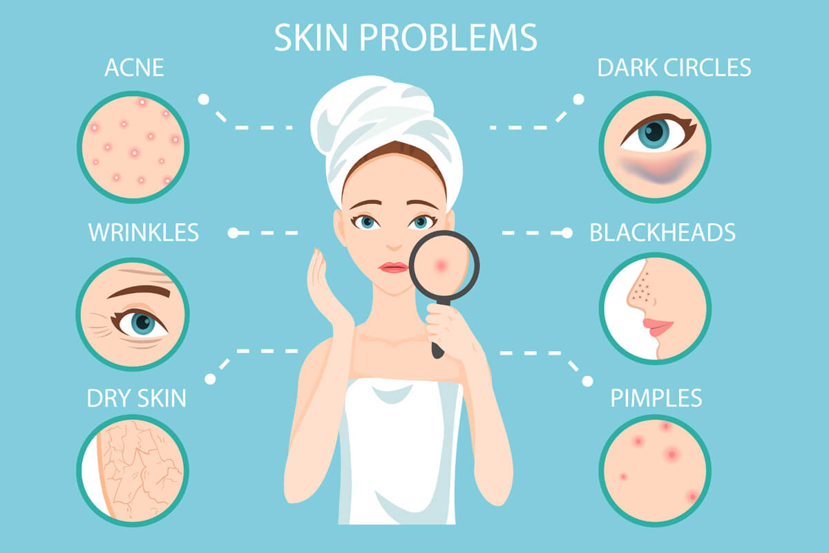 Home-Remedies-For-Acne-Wrinkle-Dark-Circle-Blackheads-Dry-Skin-and-Pimples